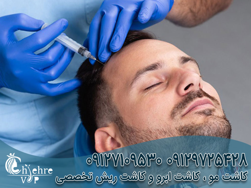 خوردن پیاز بعد از کاشت مو دکتر بهزاد دالوند